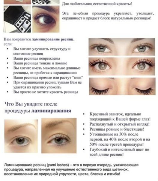 Что нужно знать об уколах ботокса в область лица и шеи
